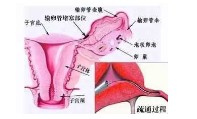 重慶送子鳥(niǎo)醫(yī)院